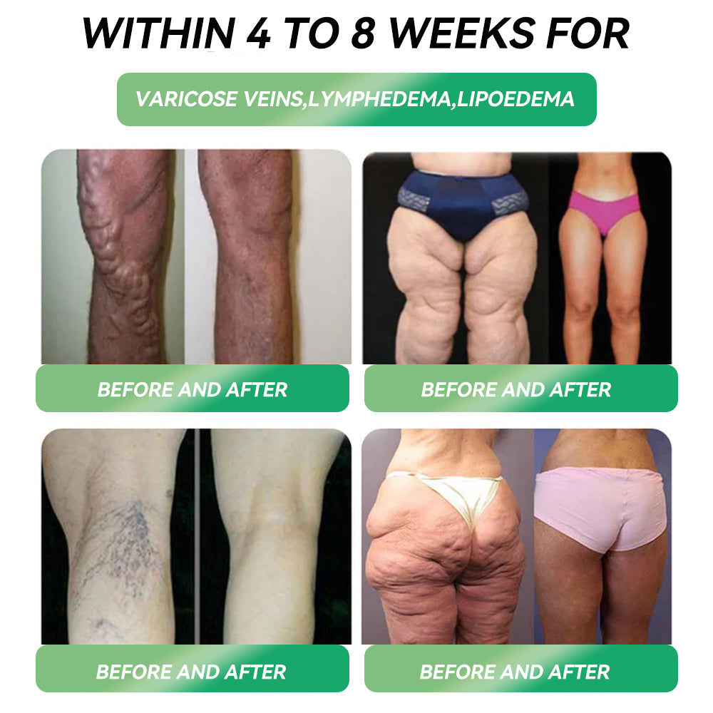 ✅Official Store | STDEI® GLP-1 Weight Loss Solution 💧 Just once a week, visible changes in 7 days ✅ For obesity, cardiovascular health, diabetes, sleep apnea, joint issues, and more